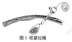 一次性使用內(nèi)窺鏡用活檢袋注冊審查指導(dǎo)原則（2025年第20號）(圖3)