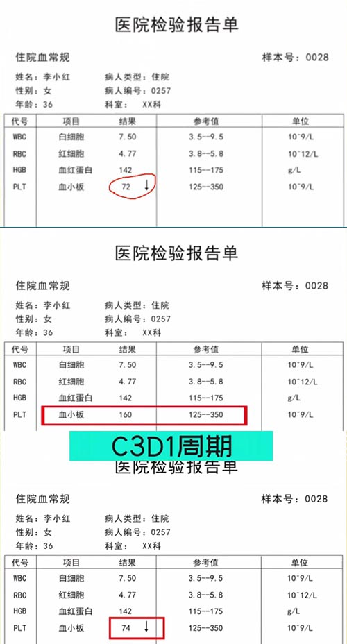 AE與研究藥物關(guān)系記錄不一致，如何處理？