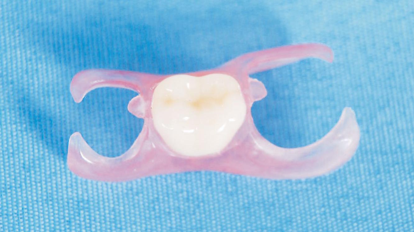 定制式義齒注冊技術(shù)審查指導原則(2018年修訂)(2018年第80號)(圖1) 定制式義齒注冊技術(shù)審查指導原則(2018年修訂)(2018年第80號)(圖1)