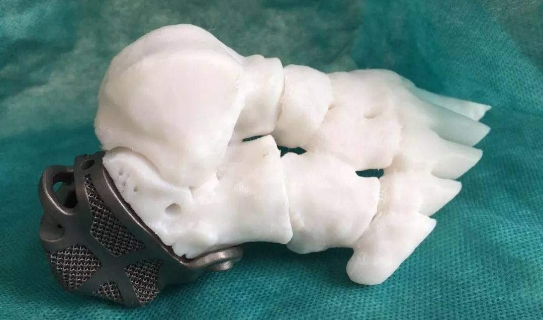 定制式個性化骨植入物等效性模型注冊技術(shù)審查指導(dǎo)原則(2020年第48號)(圖1) 定制式個性化骨植入物等效性模型注冊技術(shù)審查指導(dǎo)原則(2020年第48號)(圖1)